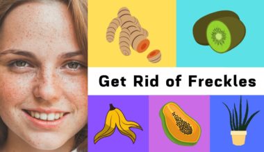 Home Remedies For Freckles
