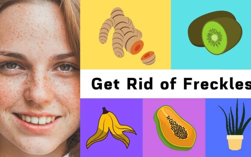 Home Remedies For Freckles