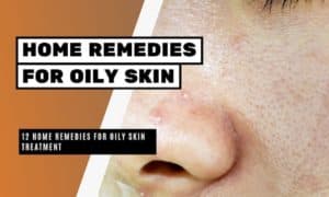 12 Home Remedies for Oily Skin Treatment