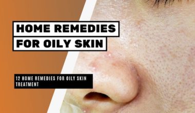 12 Home Remedies for Oily Skin Treatment
