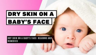 Remedies for Dry Skin on Baby Face