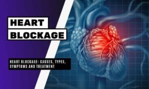 Heart Blockage Causes, Types, Symptoms and Treatment
