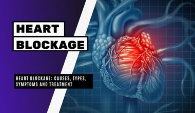 Heart Blockage Causes, Types, Symptoms and Treatment