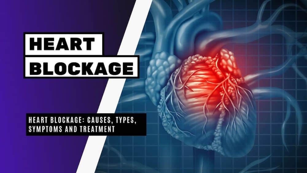 Heart Blockage Causes Types Symptoms And Treatment Bright Freak